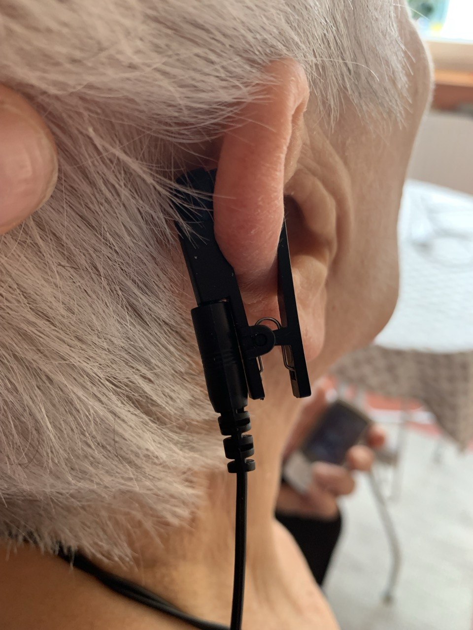 NeuroVitalElectrode: For bilateral attachment to the cymba conchae